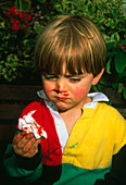 Three-year-old boy with nosebleed