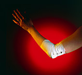 View of a bandaged elbow