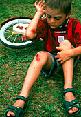 Six year old boy examining grazes on arm and leg