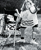 Young woman with spina bifida throws a horseshoe