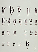 Karyotype showing arrangement of chromosomes