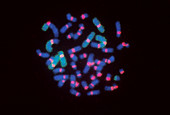 FISH micrograph of abnormal chromosomes