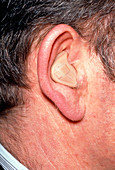 Multi-channel automatic hearing aid in man's ear
