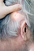Baha hearing system check-up