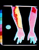Thermogram of a person's arms and hands