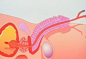 Artwork showing urinary catheterisation