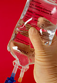Hand holds intravenous drip bag containing saline