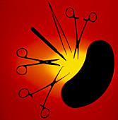 Silhouette of assorted surgical equipment