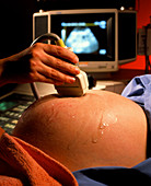 Ultrasound scanning of a pregnant woman's abdomen