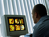 Gynaecologist with foetal scans