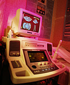 Ultrasound scanner