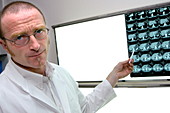 Radiologist studying abdominal CT scans