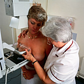 Cranio caudal mammography examination of breast