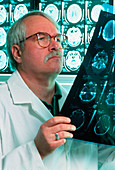Doctor studying film of CT head scans