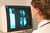 Breast X-ray
