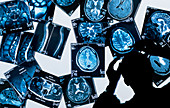 Doctor examining array of MRI scans on lightbox