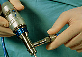 View of an arthroscope held in a surgeons hands