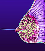 Breast cancer endoscope