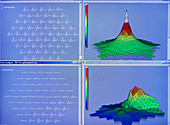 Electroretinogram eye tests