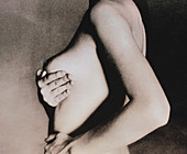Woman palpates breast during self-examination