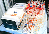 Bioreactor in bio-artificial kidney research