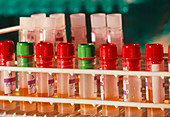 Blood product: tubes of human serum in a rack