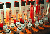 Rack of blood and serum samples for AIDS research