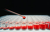 Immunoassay: sample wells being filled by pipette