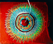 Electrical field blood test showing normal blood