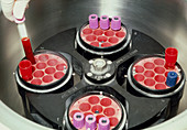Blood samples being loaded into a centrifuge