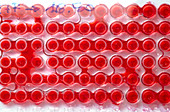 Multi-well tray of blood for HLA tissue typing