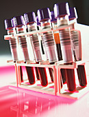 Sample tubes of blood for analysis