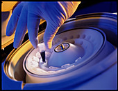 Hand loading a blood sample into a centrifuge