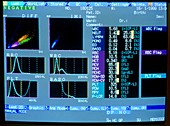 Screen showing negative blood test for infection