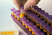Monolisa EIA test for hepatitis C virus antibodies