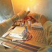 Umbilical cord blood testing