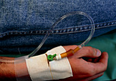 Intravenous drip inserted in Vein of Patients hand