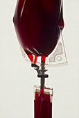 Bag of blood used for transfusion with an IV drip