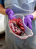 Human placenta for stem cell harvesting