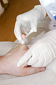 Inserting an intravenous catheter