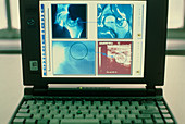 Laptop computer screen showing medical images