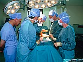 Surgical team during a gall bladder removal