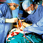 Prostate surgery