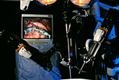 Robotic surgery