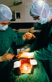 Mitral valve replacement operation