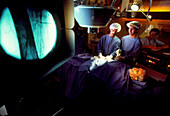 Angioplasty surgery