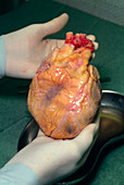Hands holding freshly removed human heart