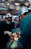 Open heart surgery