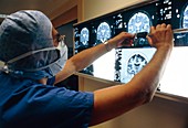 Surgeon & MRI scan used in robotic brain surgery