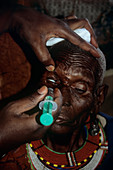 Eye surgery,Kenya